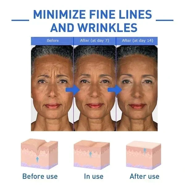 Last Day Promotion 70% OFF - đ„Botox Face Serum