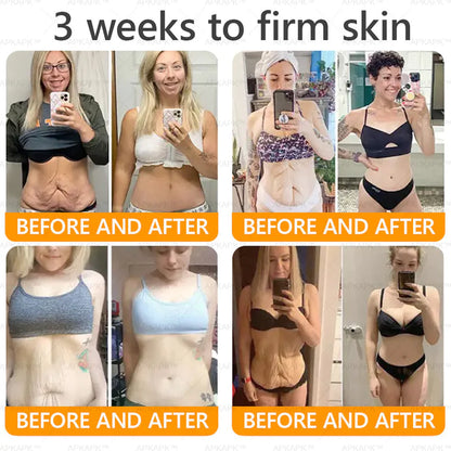 🔥Buy one get one free🔥BeeRx™ Cream |