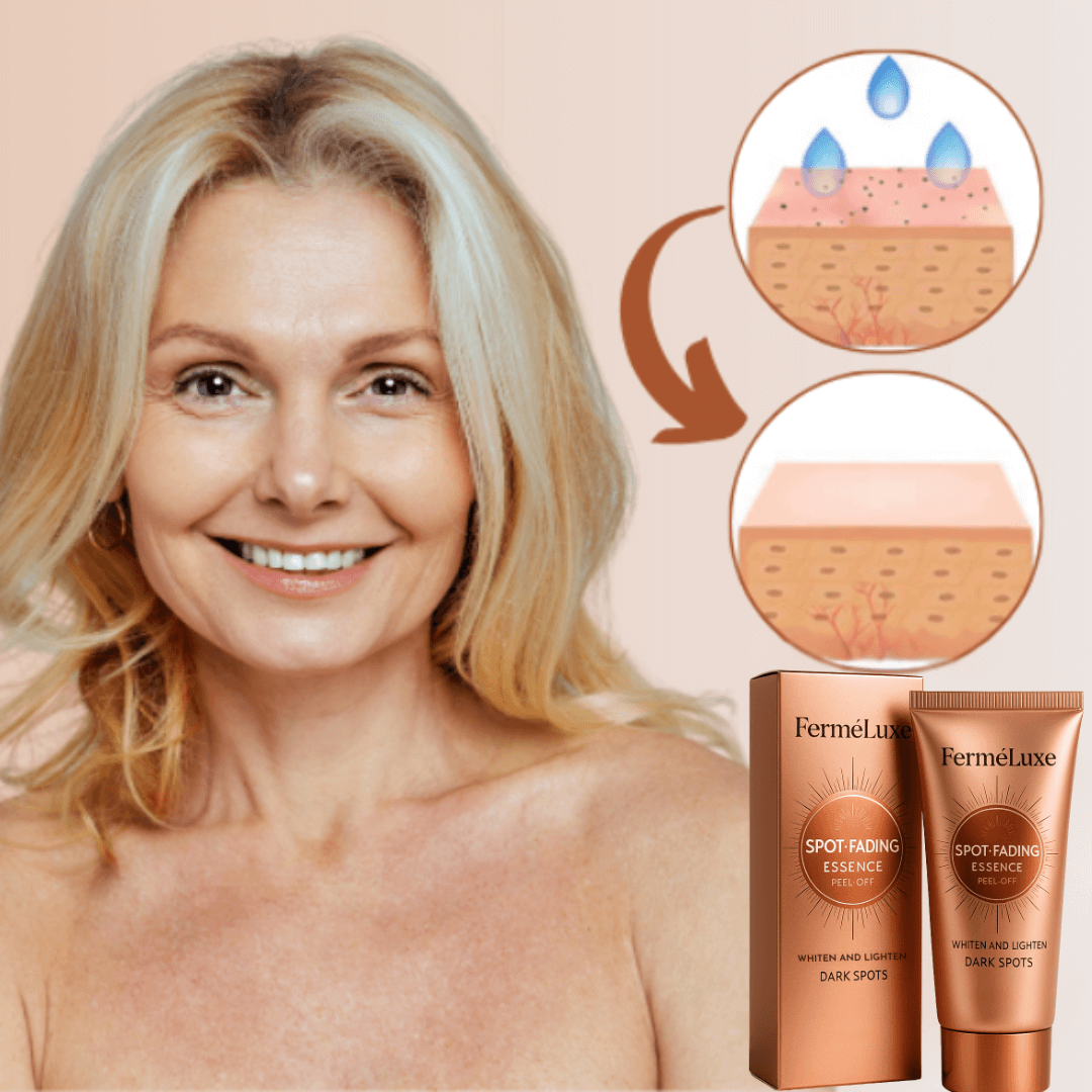 FerméLuxe Peel-Off Face Mask | Removes Sunspots & Pigmentation in Just 7 Days!