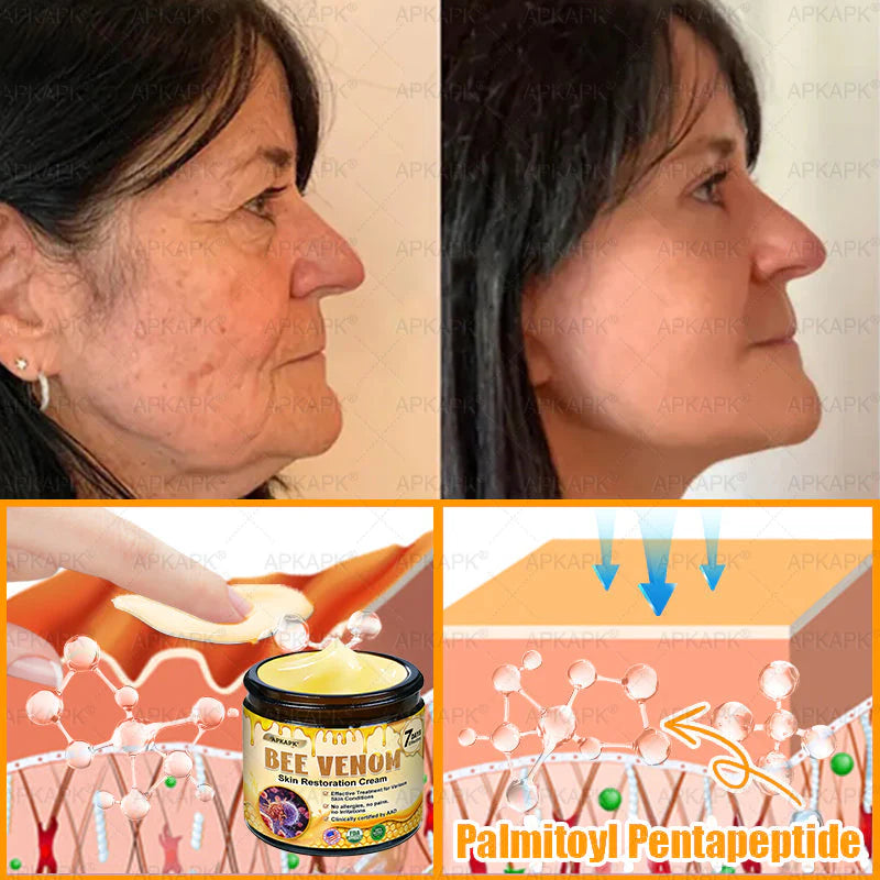 🔥Buy one get one free🔥BeeRx™ Cream |