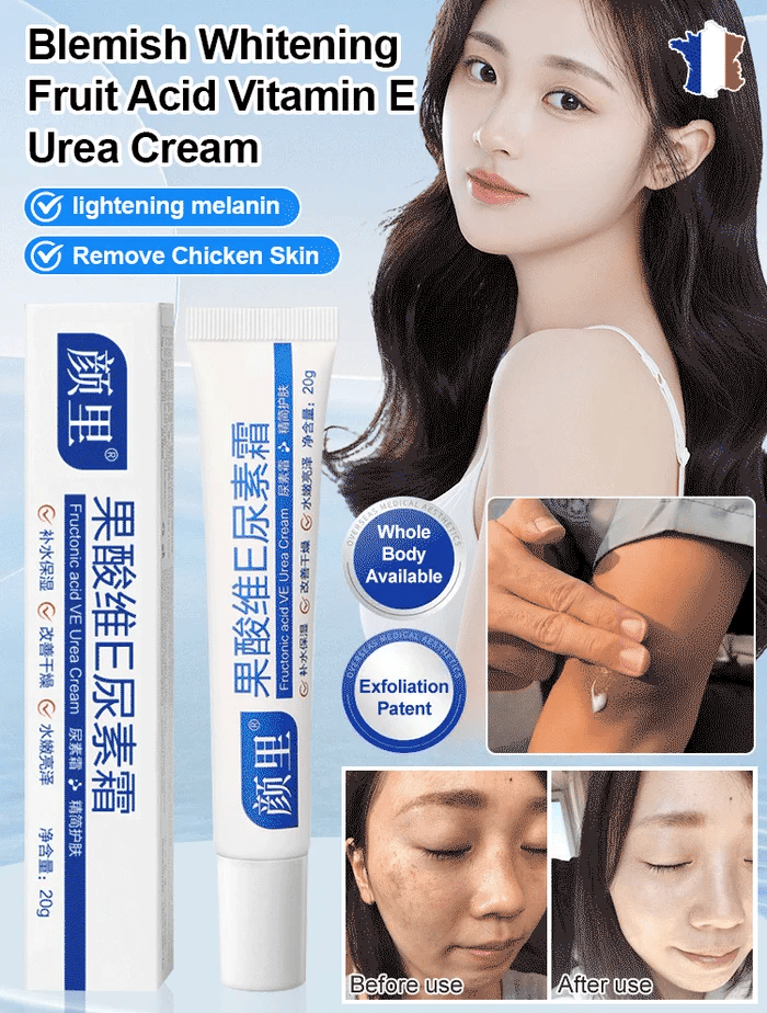 Glycolic Acid Vitamin E Urea Cream for Lightening Spots and Whitening