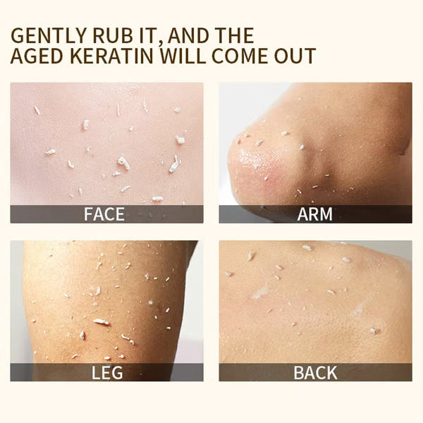 🔥Buy one get two free🔥Orange Enzyme Exfoliating Gel 50g – Facial Cleansing Peel