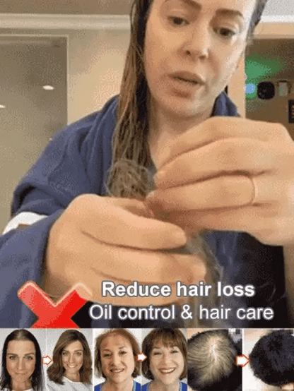 🔥Hot Sale 🔥Ginger Plant Extract Anti-Hair Loss Hair Shampoo