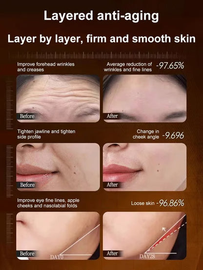 【One touch to remove wrinkles】Micro-molecular collagen anti-wrinkle lotion