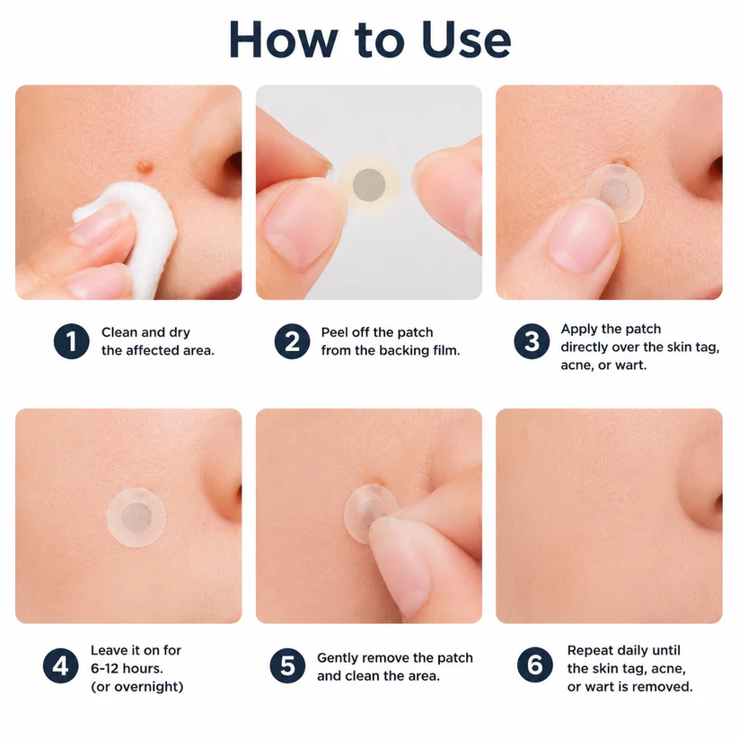 ✨ShapeOil®2-in-1 Microneedle & Hydrocolloid Patch🍀| Removes Raised Moles, Acne, Flat Warts & Skin Tags | Helps Improve Wrinkles, Scars & Blemishes | Invisible Patches for Face & Body