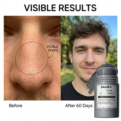 Pore & Acne Clay Mask Stick Duo