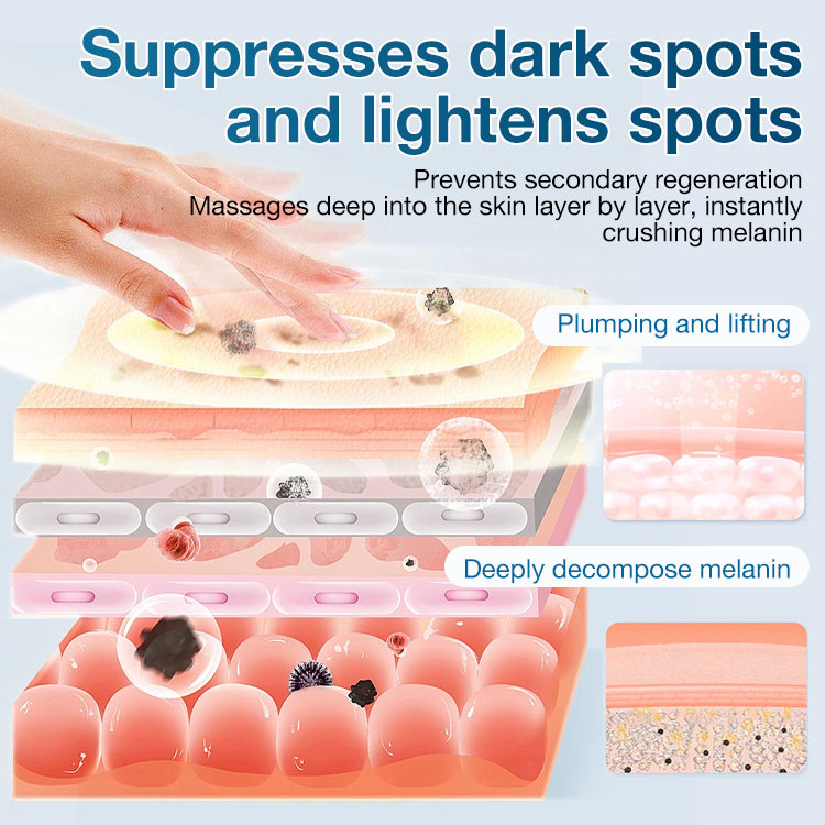 Tranexamic Acid Cream