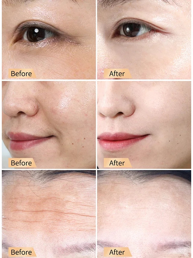 Snail Hydrating Anti-Wrinkle and Rejuvenating Cream🔥Buy 2 Get 1 Free🔥