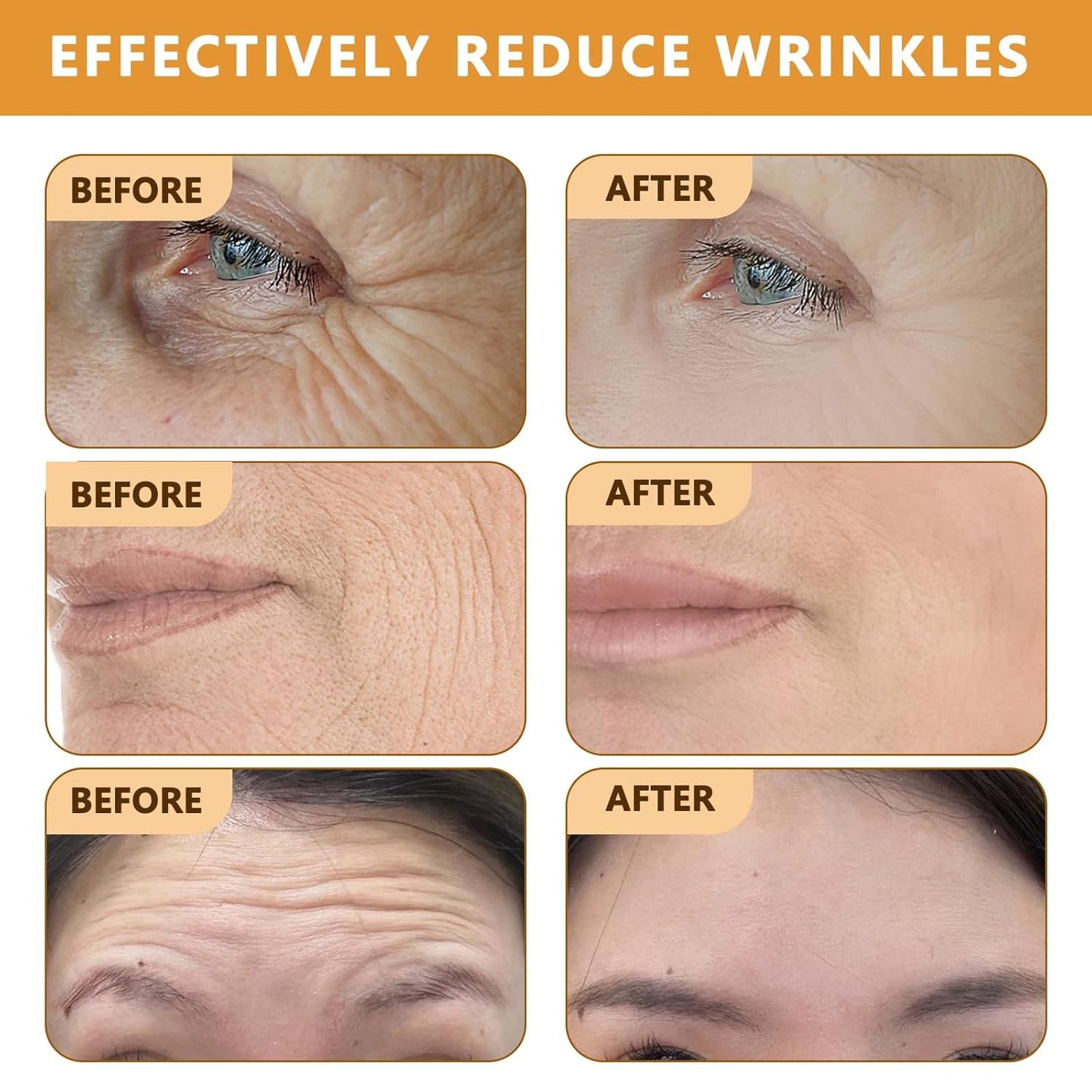 🔥Buy 2 Get 1 Free🔥2025 New Instant Botoxin Bee Venom Firming Anti-Aging Wrinkle Removal Cream