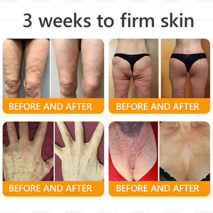 🔥Buy one get one free🔥BeeRx™ Cream |