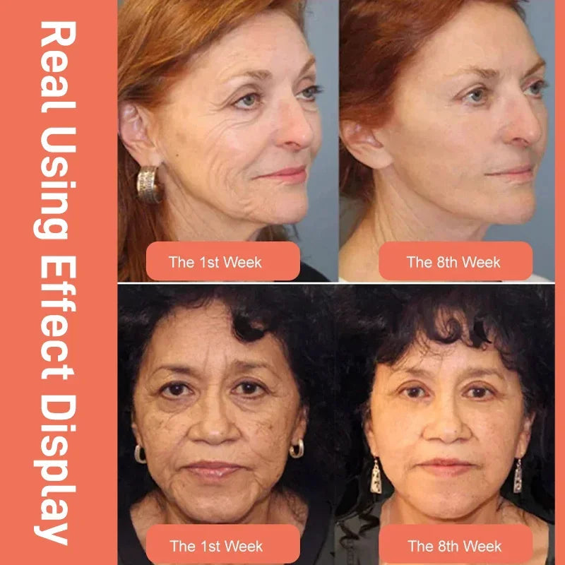 2024 NEW DRAGONS BLOOD EASY CREAM (BUY 3 GET 5 FREE)