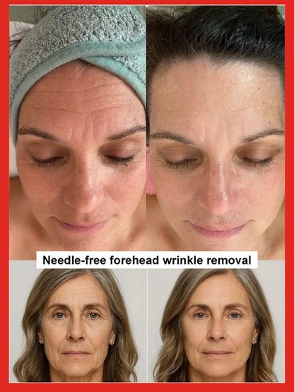 🔥BUY 1 GET 1 FREE🔥Salmon Water Light Anti-Wrinkle Essence