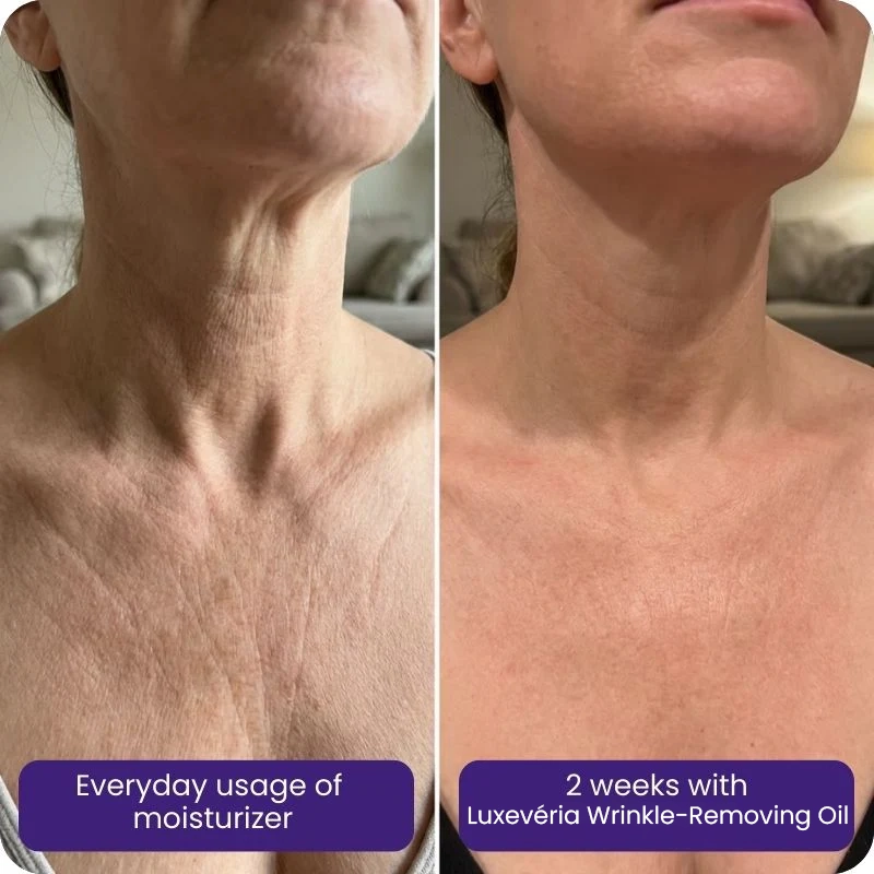 Body oil formulated for cancer survivors. Damaged skin gone in 90 days or full refund.