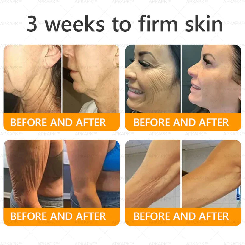 🔥Buy one get one free🔥BeeRx™ Cream |