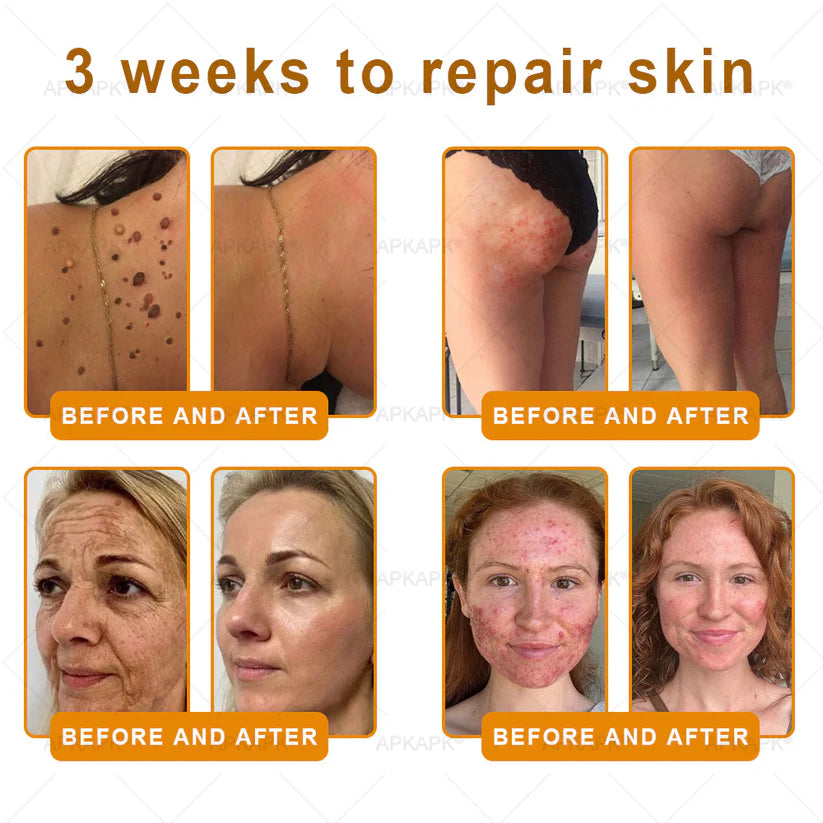 🔥Buy one get one free🔥BeeRx™ Cream |