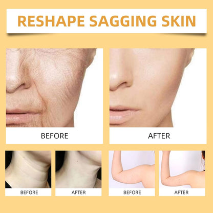 🔥Buy 2 Get 1 Free🔥2025 New Instant Botoxin Bee Venom Firming Anti-Aging Wrinkle Removal Cream