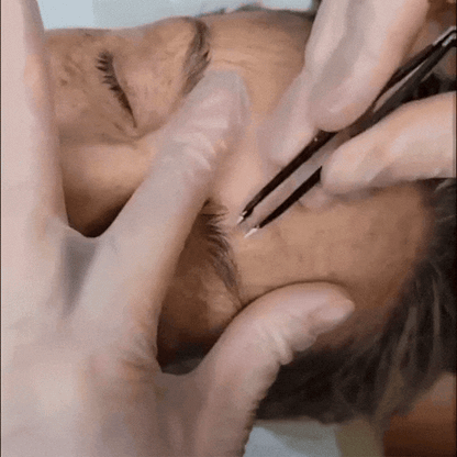 FerméLuxe Peel-Off Face Mask | Removes Sunspots & Pigmentation in Just 7 Days!