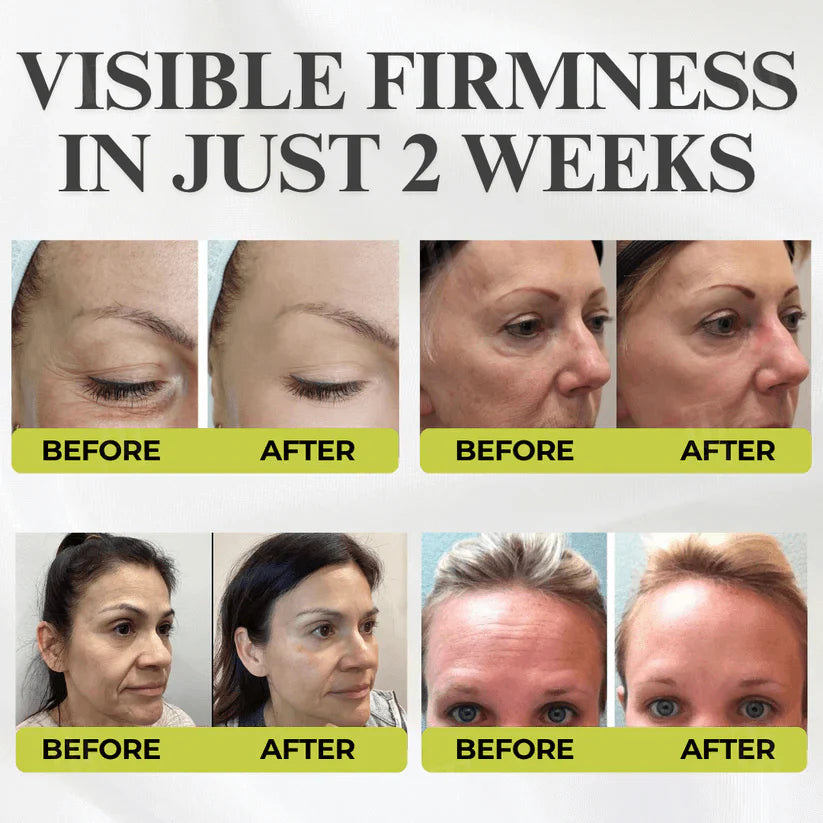 👏🌿Made and shipped from the USA 💫Tiworld® Botox & Vita-A Retinol Shot Wrinkle-Lift Tightening cream - Last Day Promotion 70% OFF