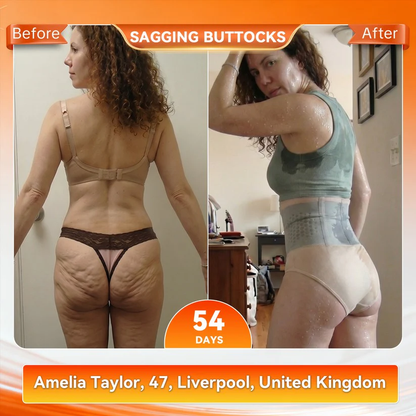✨Last Day 80% Off Moringa & Berberine 4-In-1 Micro-Particle Sculpting & Fat-Burn Shorts