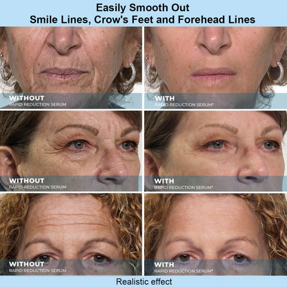 Results In 60 Seconds - Lunivéa™ Rapid Wrinkle-Reducing Serum for Wrinkles, Bags & Dark Circles