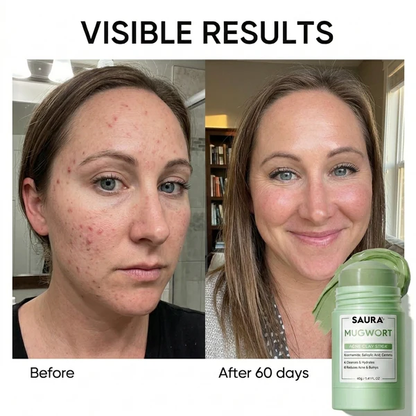 Pore & Acne Clay Mask Stick Duo